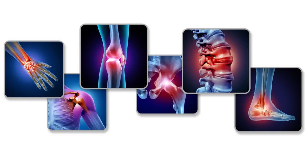 Locations of muscle and joint pain